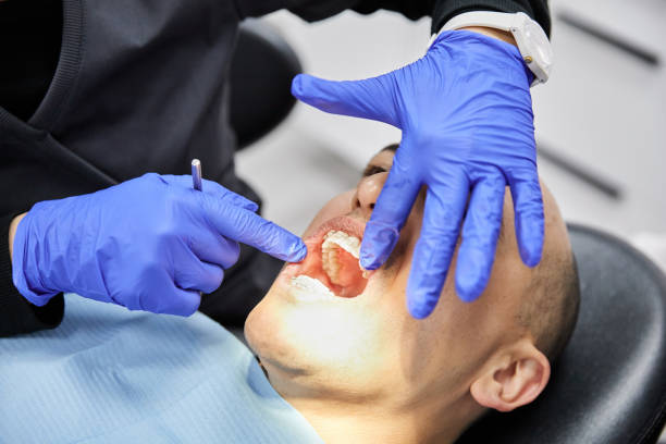 Best Emergency Treatment for Dental Infections or Abscesses in Plymouth, PA
